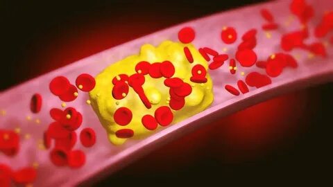 Cholesterol