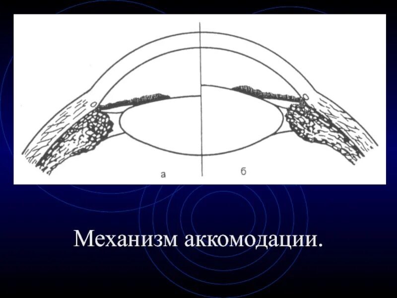 Коррекция аккомодации. Схематическое представление механизма аккомодации. Аккомодация глаза физиология. Аккомодация, её механизм схема. Механизм аккомодации глаза физиология.