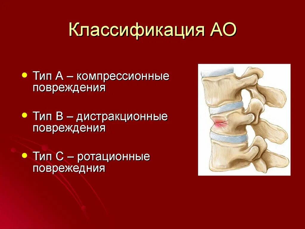 Переломы позвонков классификация АО. Компрессионный перелом позвонка классификация. Классификация травм позвоночника. Повреждения позвоночника травматология.