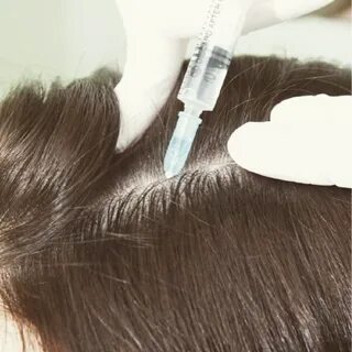 Лучшая мезотерапия волос