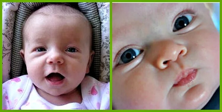 Мешки под глазами у новорожденного. Мешки под глазами у месячного ребенка. Глаза грудничка. Мешки под глазами у грудничка 3 месяца.