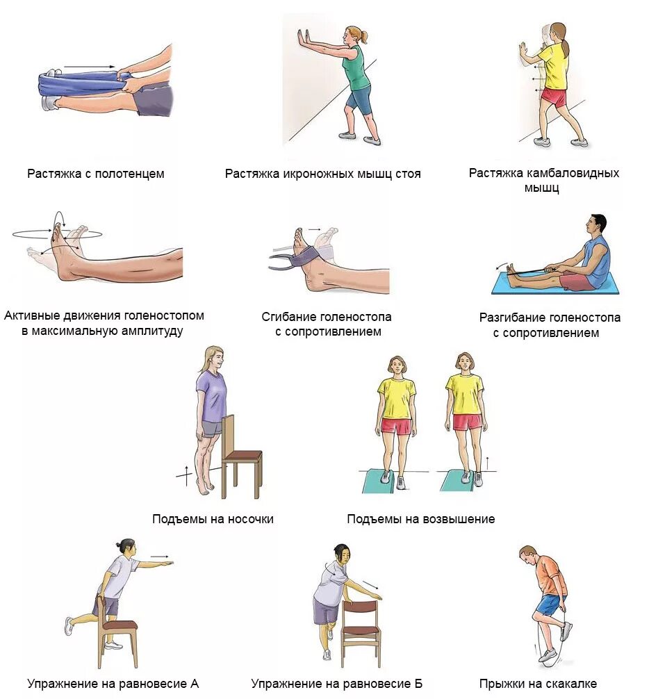 Упражнения ЛФК для голеностопа после разрыва связок. Упражнения для восстановления голеностопа после растяжения связок. Упражнения для укрепления мышц после растяжения голеностопа. Упражнения для укрепления голеностопа после травмы связок. Упражнения при полинейропатии