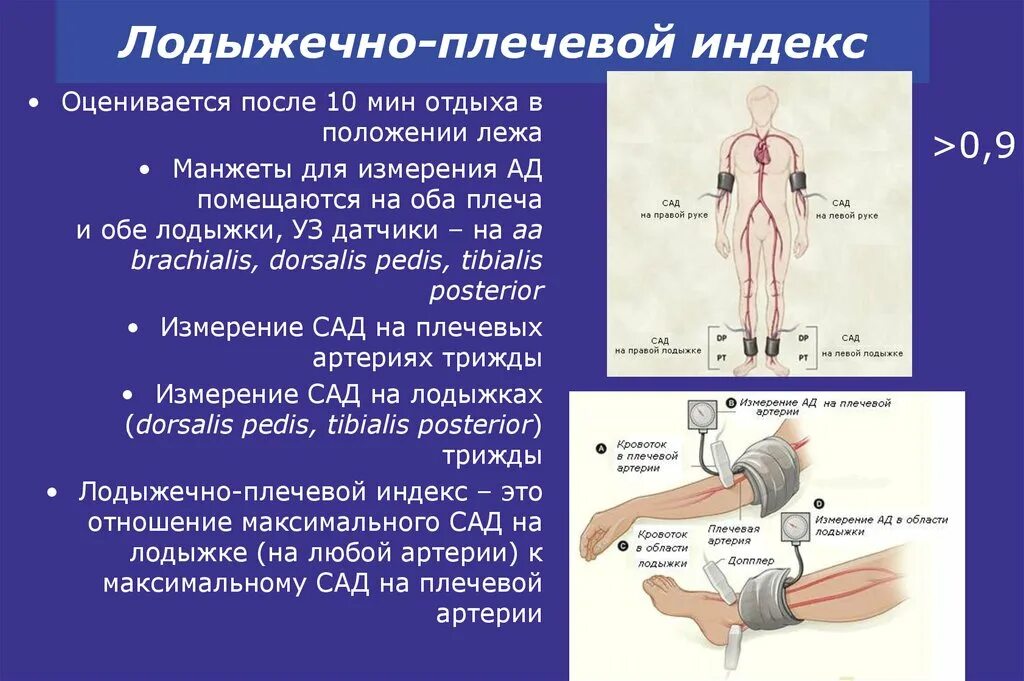 Лодыжечно-плечевой индекс методика измерения. Нормальные показатели лодыжечно-плечевого индекса: *. Алгоритм измерения лодыжечно-плечевого индекса. Измерение лодыжечного давления.