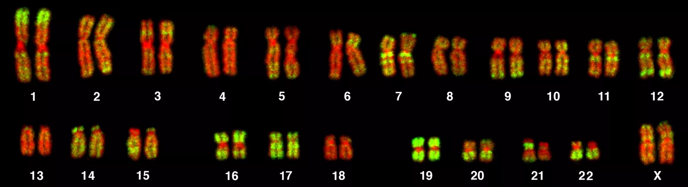 Окрашивание и рассматривание под микроскопом хромосом Chromosome Painting Best Sale --p1ai