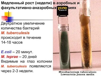 Моча на микобактерии туберкулеза