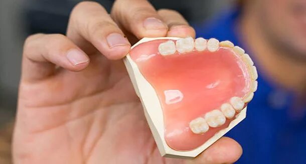 На зубного техника после 9. Техника полировки зубных протезов. Шлифованная восковая модель протеза. Подготовка зубов к протезированию. Полировка протезов в полости рта.