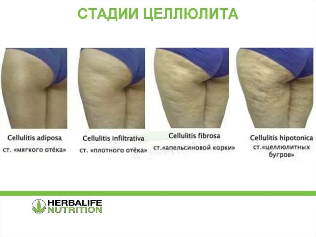 Пол ягодицы. Пол ягодицы