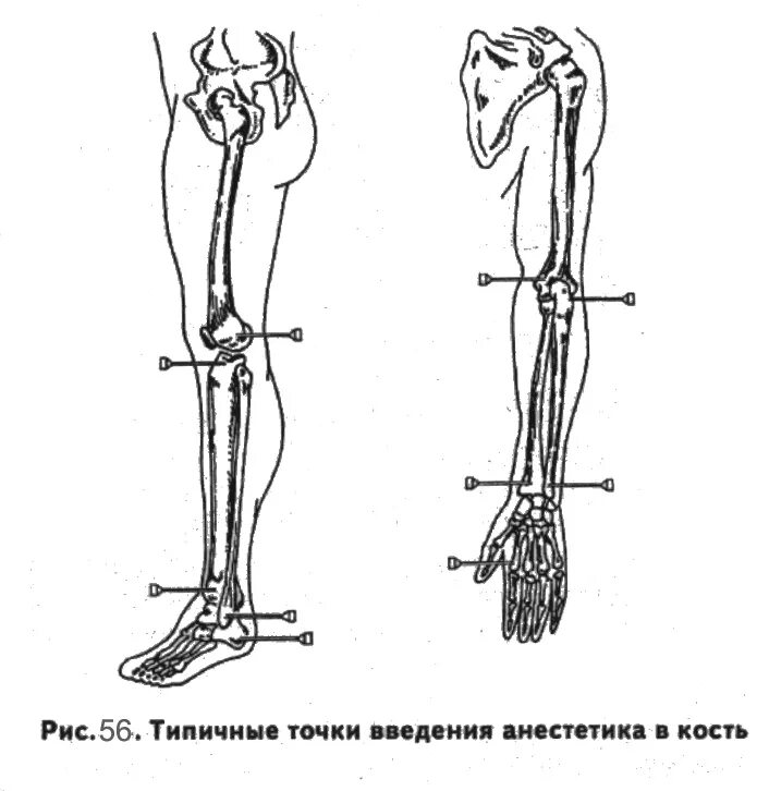 Развитие нижней конечности. Проксимальный отдел нижних конечностей. Внутрикостная анестезия на верхней конечности. Проводниковая внутрикостная анестезия. Внутрикостная регионарная анестезия.