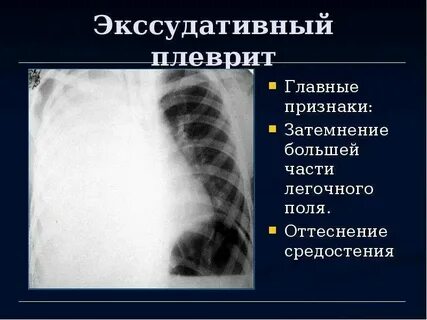 Стойкое тотальное нарушение