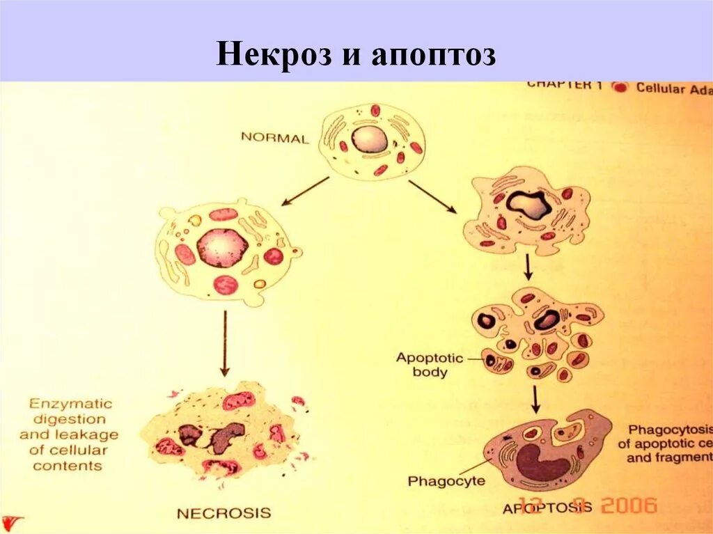 Схема гибели клеток при некрозе и апоптозе. Апоптоз и некроз схема. Апоптоз отмирание клеток. Схема апоптоза и некроза.