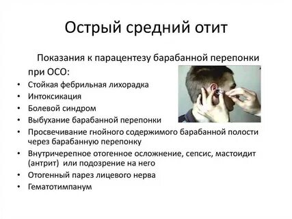 Лечение острого среднего отита у взрослых