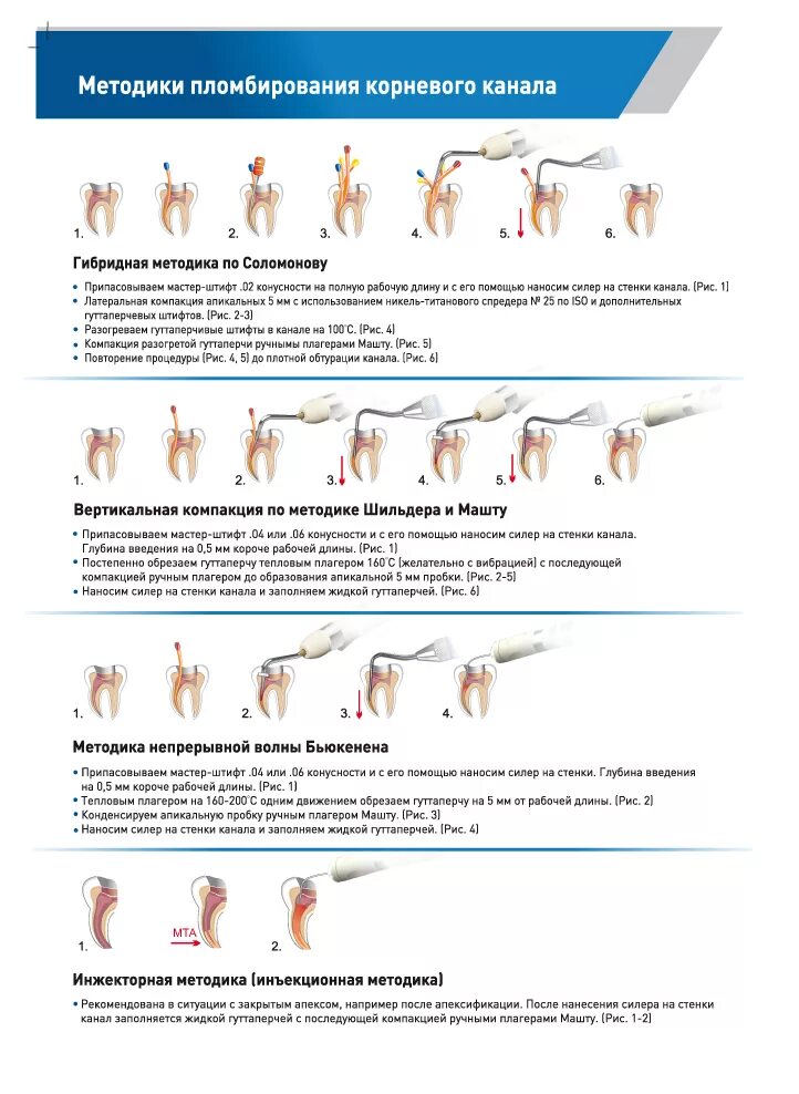 Методы пломбирования корневых. Гибридная методика пломбирования корневых каналов. Гибридная методика пломбирование корневых каналов по Соломонову. Гибридная методика обтурации корневых каналов по Соломонову. Аппарат для обтурации корневых каналов разогретой гуттаперчей.