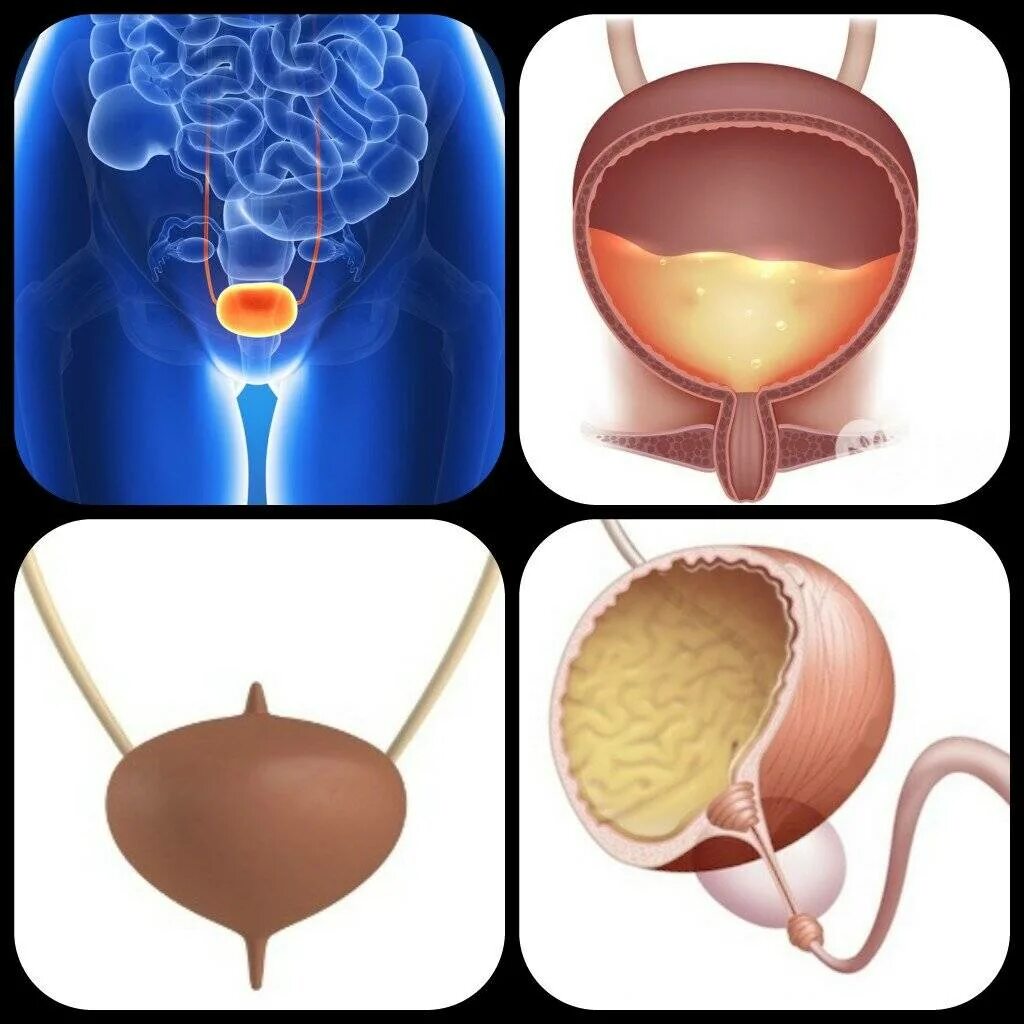 Мочевой пузырь у мужчины видео