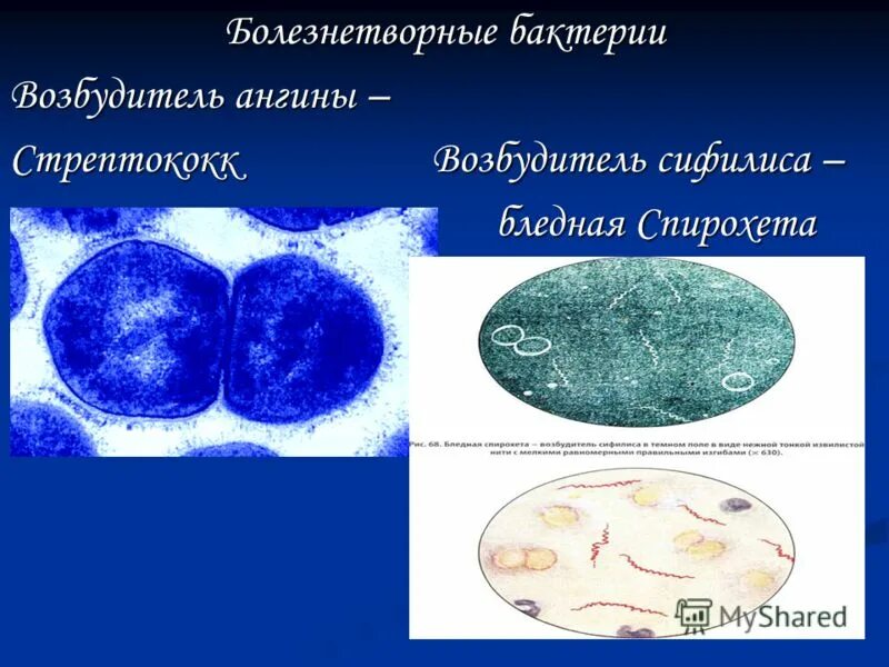 Болезнетворные бактерии биология. Ангина возбудитель бактерия. Возбудитель ангины стрептококк. Тонзиллит возбудитель. Болезнетворные бактерии.