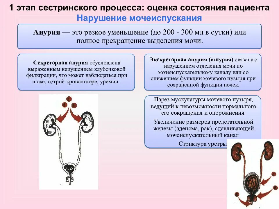 1этар сестринского процесса оценка состояния пациента. Потребность в физиологических отправлениях сестринский процесс. Оценка состояния пациента этап сестринского. 1 Этап сестринского процесса оценка состояния пациента. Уменьшение мочеиспускания