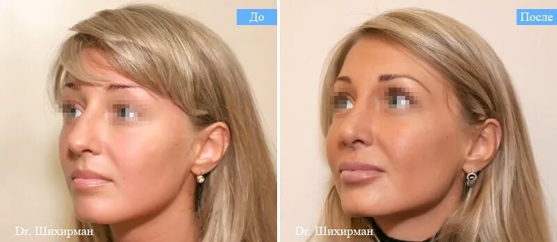 труфанов дмитрий алексеевич. попугаев пластический хирург увильды. попугаев павел вадимович пластический. доктор попугаев челябинск. александр пухов хирург.