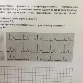 Электрокардиография один из важных