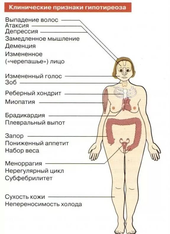 Аутоиммунное заболевание щитовидной железы симптомы. Аутоиммунный тиреоидит гипотиреоз. Аутоиммунный тиреоидит гипертиреоз. Аутоиммунный тиреоидит симптомы.