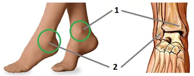 Медиальная и латеральная лодыжки. Голень, голеностопный сустав, стопа. Медиальная лодыжка расположена. Голеностоп кость сбоку.