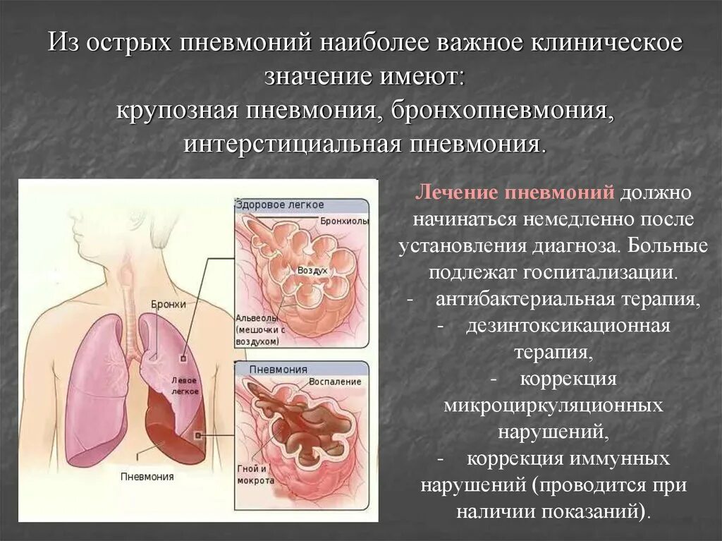 Осложнения при крупозной пневмонии. Клинические проявления крупозной пневмонии. Крупозная пневмония характер мокроты. Пневмония внутренние болезни презентация.