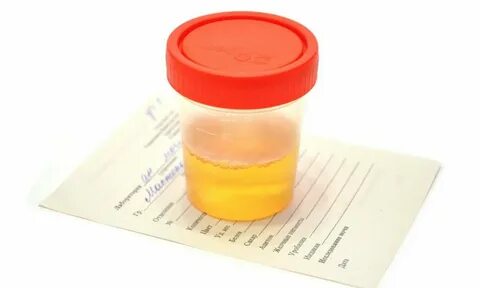 Анализ мочи по Нечипоренко - цена в СПб Клиника МедПросвет