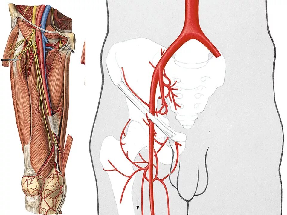 Бедренная артерия и Вена анатомия. Артерия феморалис. Запирательная артерия топография. Аневризма подвздошной артерии.
