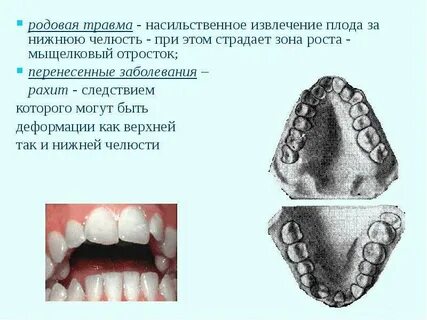 Аномалии и деформации