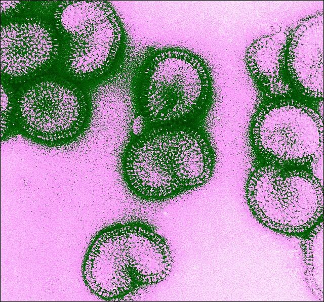 Вирус гриппа под. Вирус гриппа электронная микроскопия. Вирусы под микроскопом. Вирус гриппа под микроскопом. Электронная микрофотография вируса гриппа а.