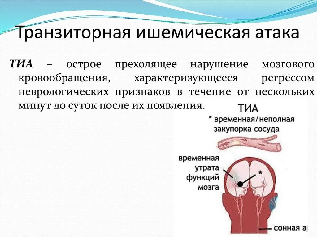 Ишемическая атака головного мозга последствия. Транзиторная ишемическая атака симптомы. Транзиторная церебральная ишемическая атака. Транзиторная ишемия атака инсульт. Тразинтлрно игемическая Птака.