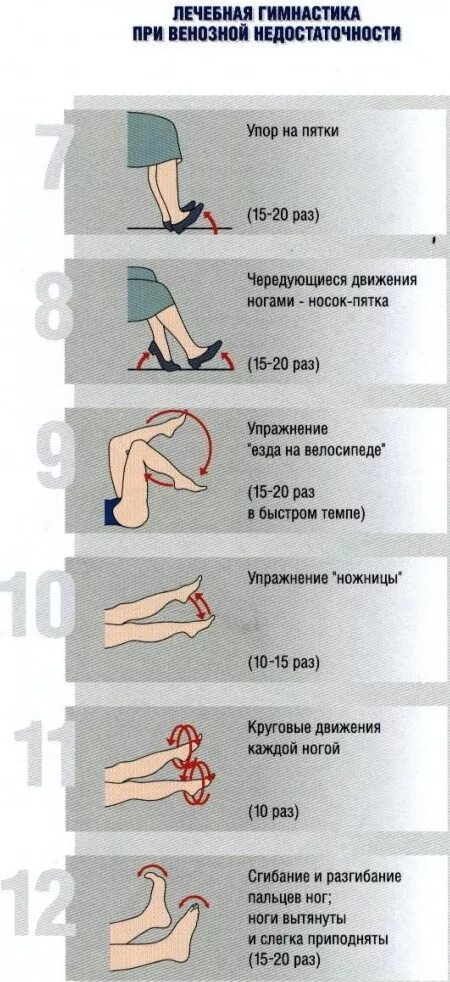Какие упражнения от отеков. Лечебная физкультура при варикозном расширении вен. гимнастика при варикозном расширении вен на ногах. упражнения при варикозе нижних конечностей гимнастика. упражнения от варикоза вен нижних конечностей.