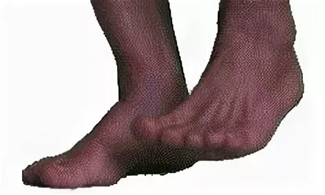 Шаркающие шаги