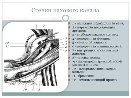 Паховое кольцо
