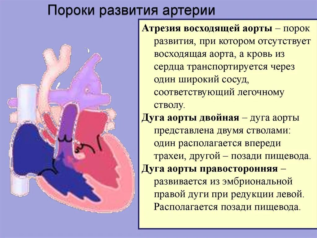 Правосторонняя дуга аорты на кт. Артерии отходящие от дуги аорты рентген.