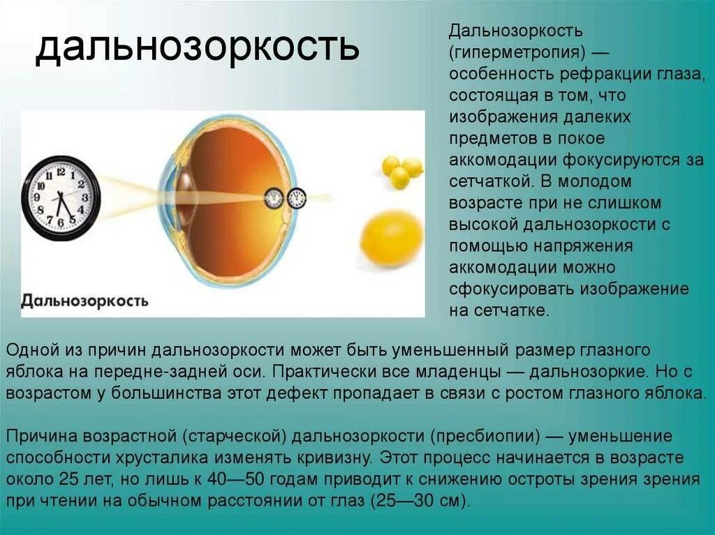 Какое преимущество дает зрение. Миопия дальнозоркость астигматизм. Гиперметропия высокой степени рефракция. Дальнозоркость (гиперметропия). Заболевание дальнозоркость.