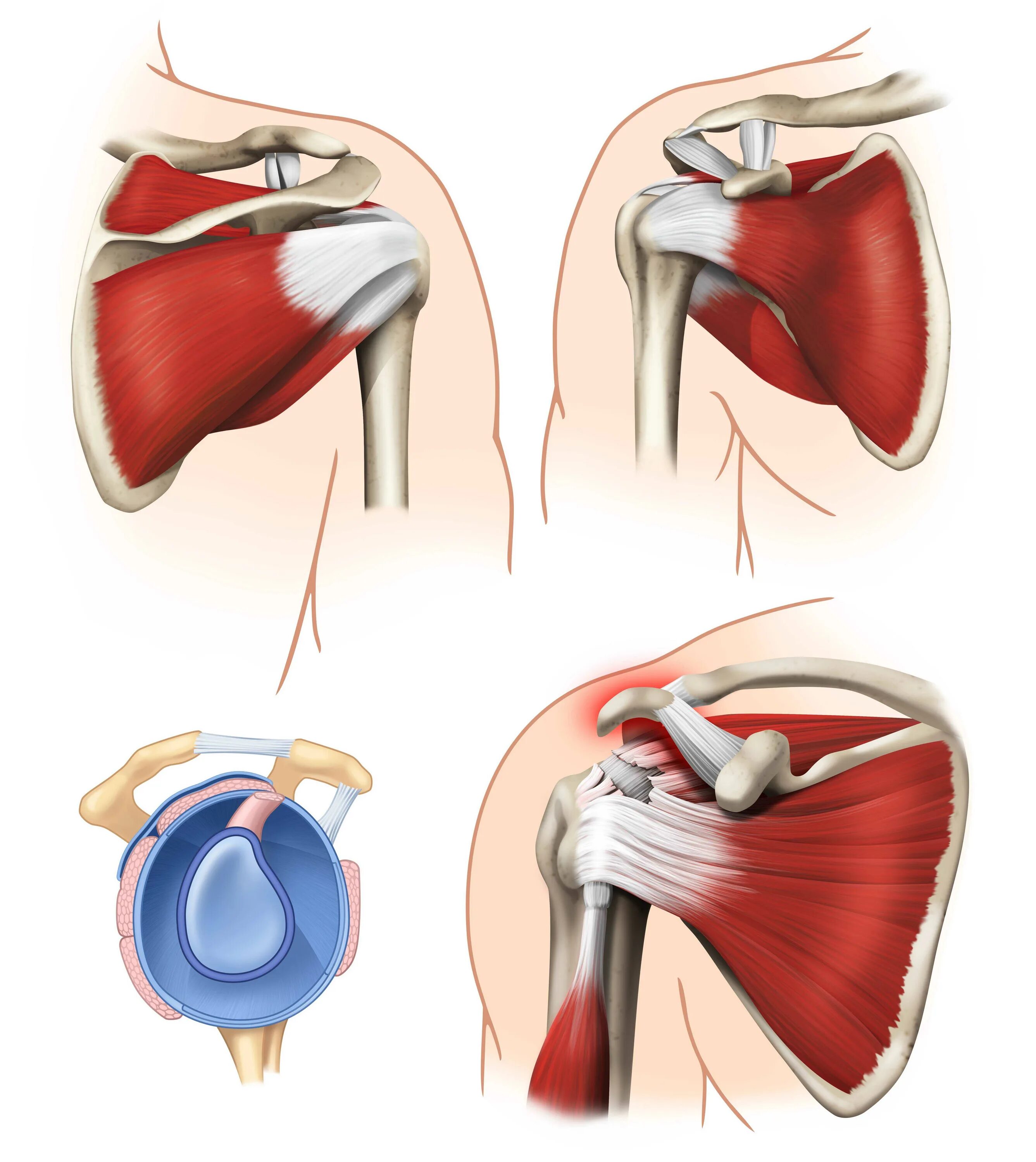 Резкая сильная боль в плечевом суставе. Ротаторная манжета плечевого. Ротаторная манжета анатомия. Ротаторная манжета плечевого сустава анатомия. Ротаторная манжета плечевого сустава мышцы.