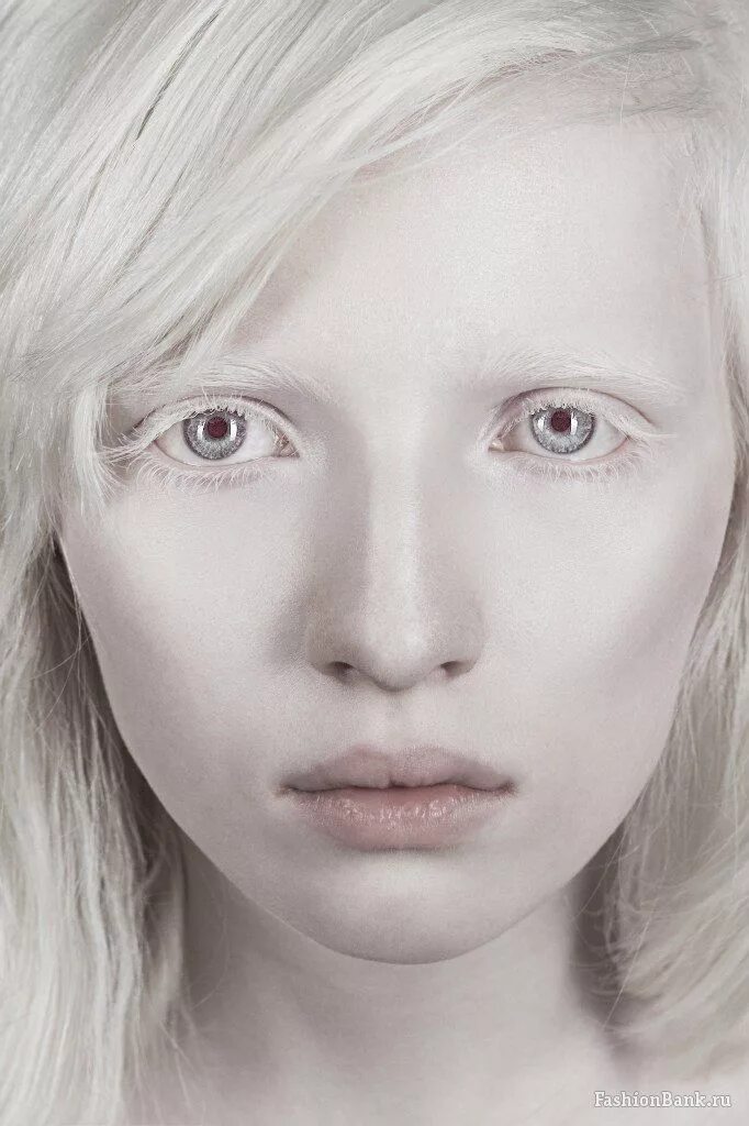 Настя Жидкова альбинос. Модель альбинос Настя Жидкова. Тося Чайкина альбинос. Настя Кумарова.