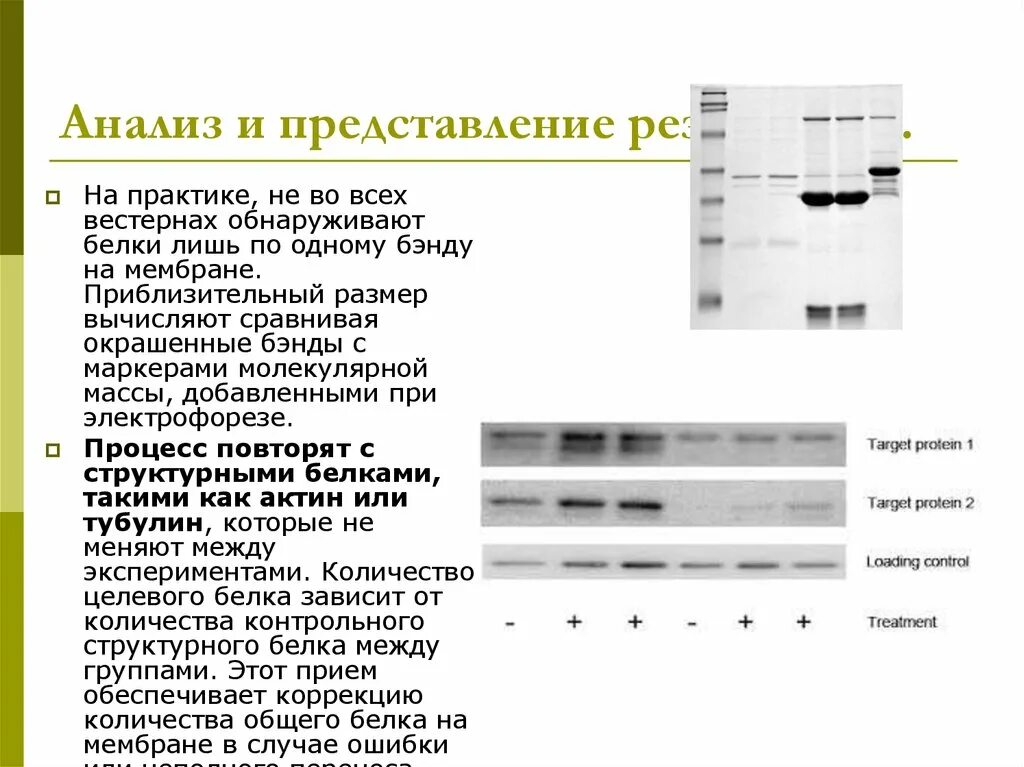 Иммуноблот ВИЧ. Иммуноблот как выглядит анализ. Иммунный блоттинг микробиология. Антинуклеарные антитела иммуноблот.