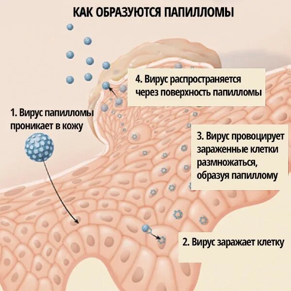 Пожалуйста помогите! Похоже на бородавки - Вопрос дерматологу - 03 Онлайн