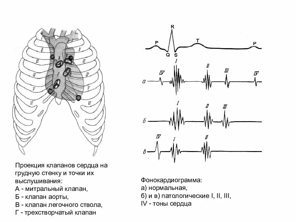 Проекция митрального клапана на грудную клетку. Проекции клапанов сердца на рентгенограмме. Проекция трехстворчатого клапана. Проекция выслушивания клапанов. Клапаны сердца на грудной клетке