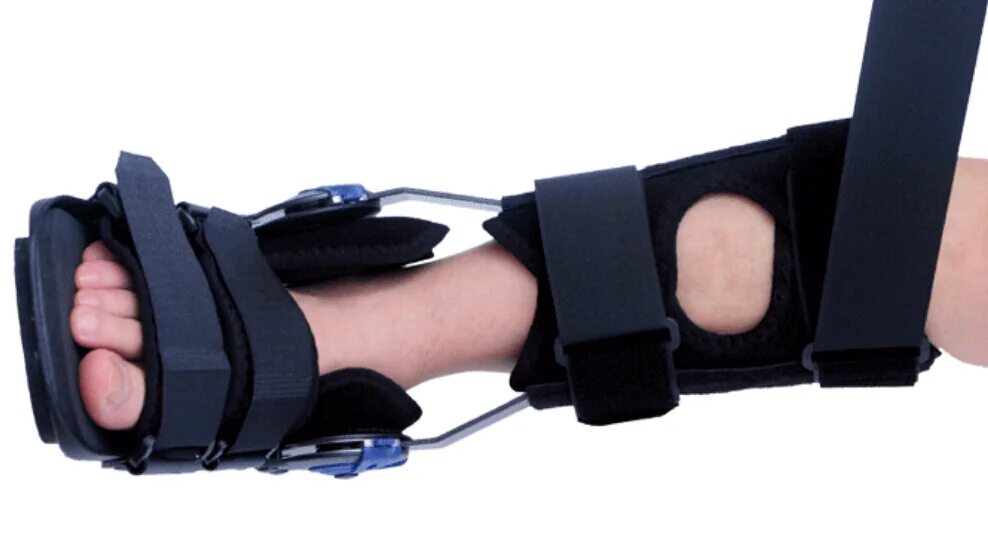 Ахиллово сухожилие растяжение. Бинтование ахиллова сухожилия. Сухожилия после гипса. Ахиллово сухожилие разрыв реабилитация. Упражнения на растяжение ахиллова сухожилия.