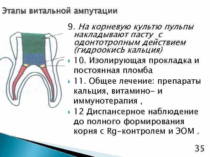 Метод ампутации пульпы. Витальная ампутация пульпы методика. Этапы витальной экстирпации пульпы схема. Методика витальной ампутации пульпы показания. Этапы лечения пульпита методом витальной ампутации.