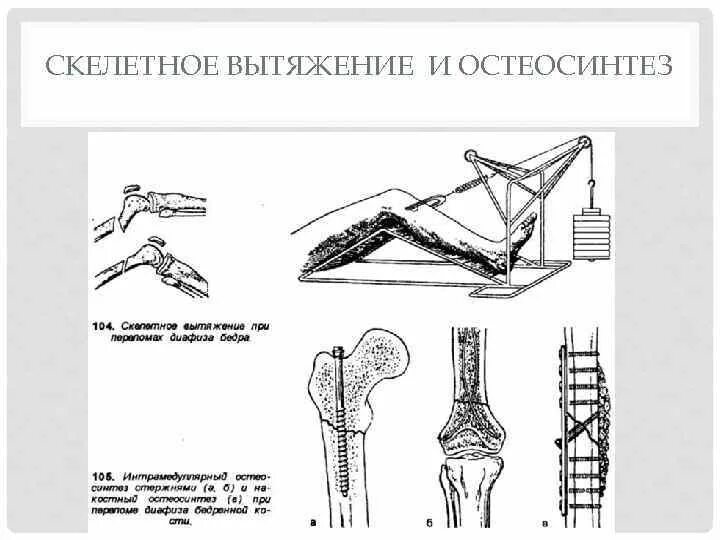 Ушиб тазобедренного сустава карта вызова