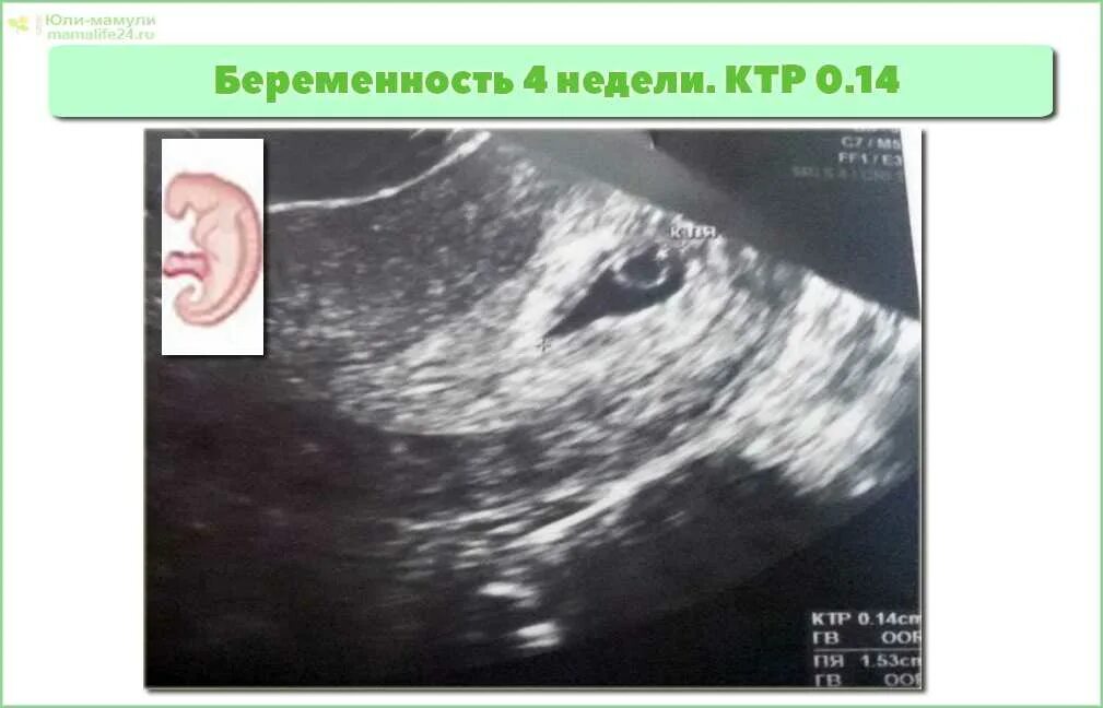 Беременность 4 недели что происходит с плодом. 3 4 недели беременности размер плода. размер плода на 4 неделе беременности. размер эмбриона на 4 неделе.