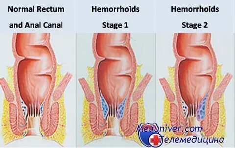 Аяқ киімнің, етіктің және өкшенің порнофотосуреттері