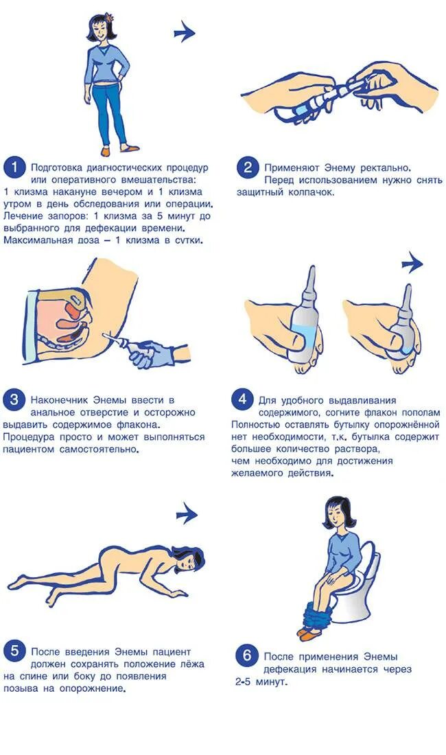 Как часто можно ставить клизму. Как правильно сделать клизму в домашних условиях самому от запора. Правильное положение для клизмы. КПК правильно поставить клизму. Очистительная клизма от запора.