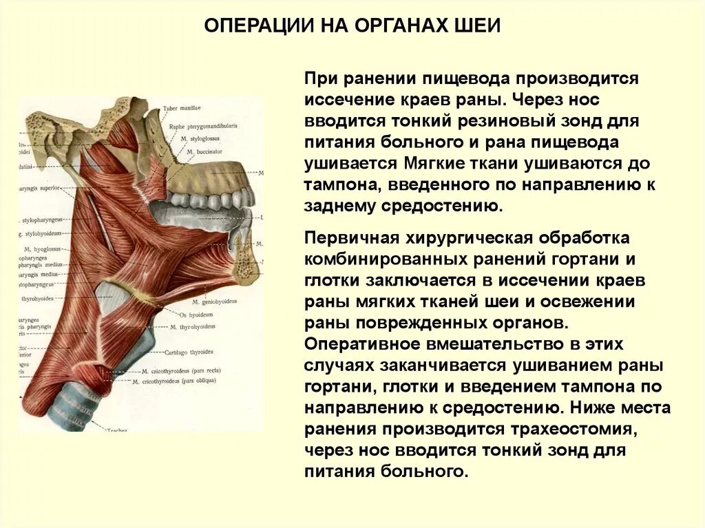 Глоток открыто. Оперативные вмешательства на органах шеи. Особенности оперативных вмешательств на шее..