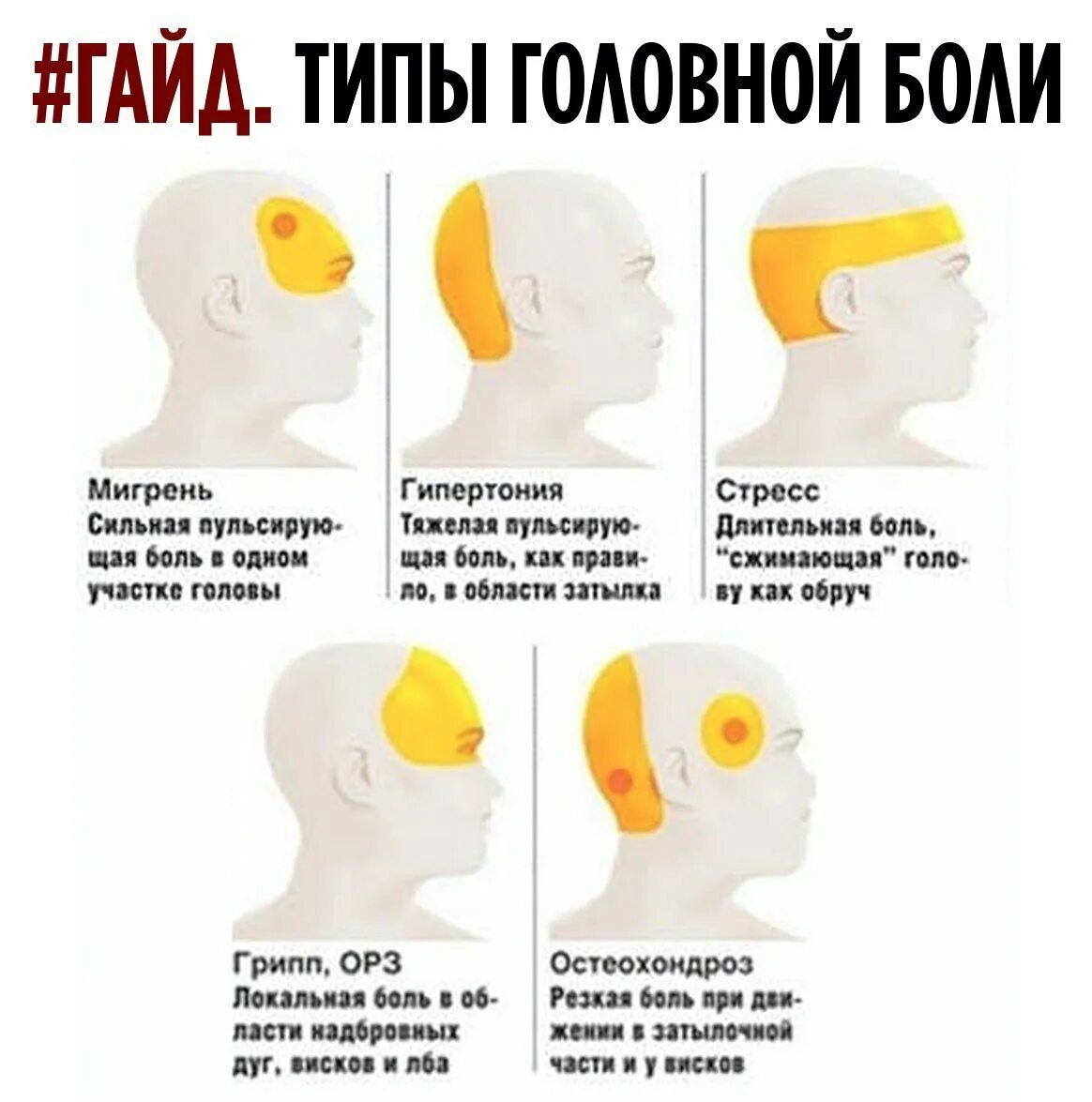 Головная боль после давления. Головная боль. типы головной боли. головная боль локализация. причины головной боли.