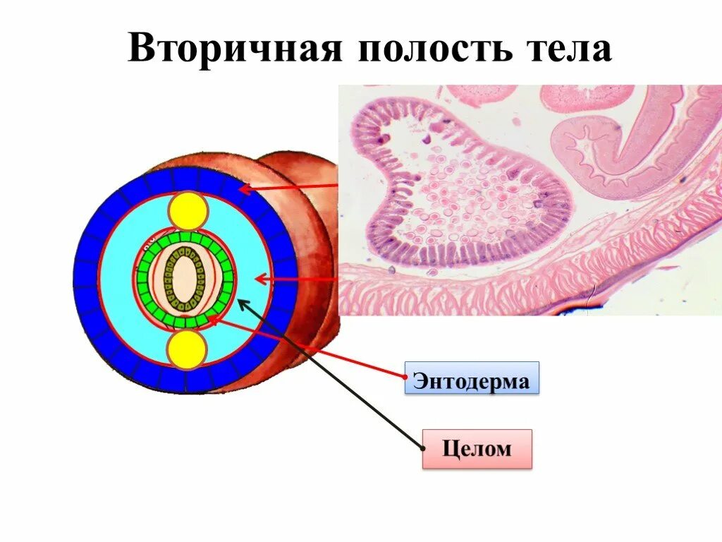 Имеет полость целом. Энтодерма вторичная полость тела. Вторичная полость целом. Вторичная полость тела целом. Полость целома это.