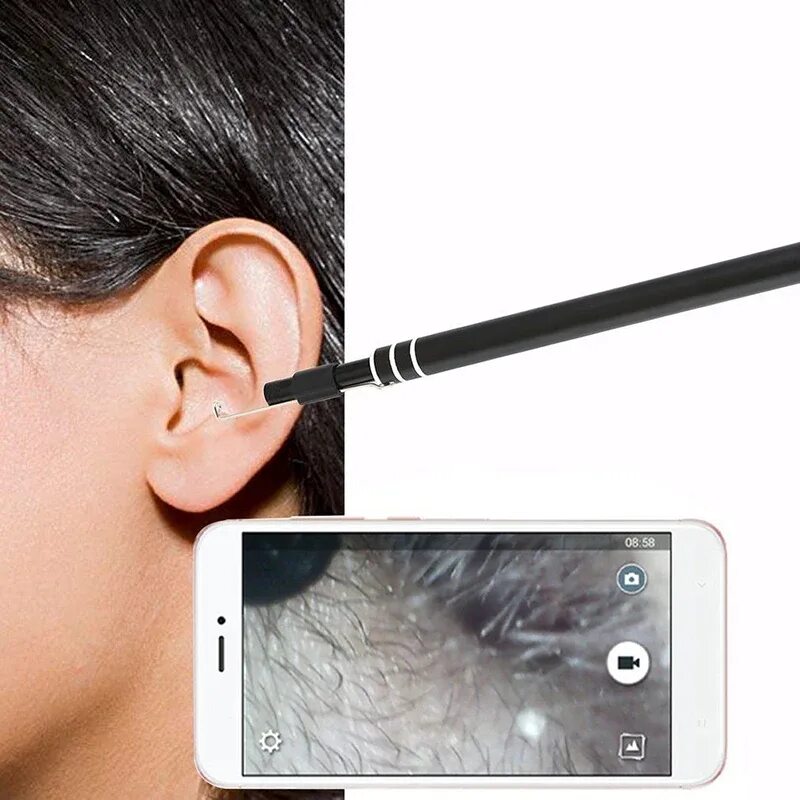 Ear cleaner wireless ear endoscope. Cauterizers. Камера ушки. Видеокамера на ухо. Очистка ушей с камерой.