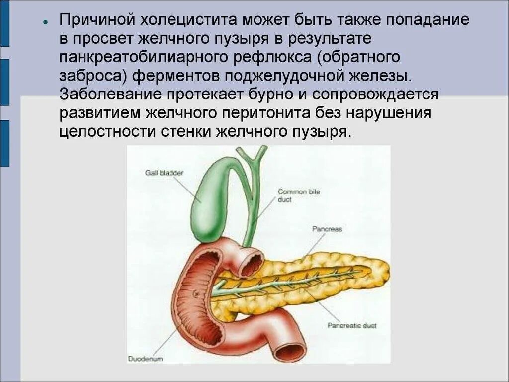 Холецистит без желчного